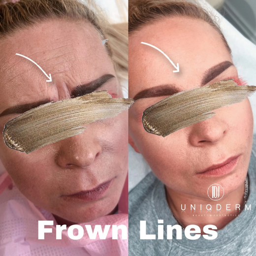 Texture / product placeholder